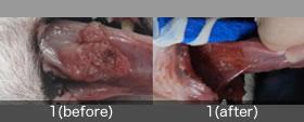 舌扁平上皮癌（治療前後）
